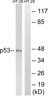 TP53 / p53 Antibody - Western blot analysis of lysates from HT-29 cells, treated with calyculinA 50ng/ml 30', using p53 Antibody. The lane on the right is blocked with the synthesized peptide.
