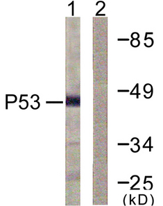 TP53 / p53 Antibody - Western blot analysis of lysates from COS7 cells, treated with TSA 400nM 24h, using p53 Antibody. The lane on the right is blocked with the synthesized peptide.