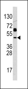 TP53 / p53 Antibody - Western blot of anti-p53 Antibody in SK-BR-3 cell line lysates (35 ug/lane). p53(arrow) was detected using the purified antibody.