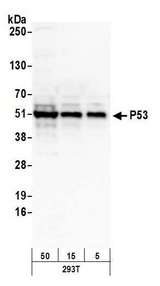 TP53 / p53 Antibody - Detection of human P53 by western blot. Samples: Whole cell lysate (5, 15 and 50 µg) from HEK293T cells prepared using NETN lysis buffer. Antibody: Affinity purified rabbit anti-P53 antibody used for WB at 0.1 µg/ml. Detection: Chemiluminescence with an exposure time of 30 seconds.