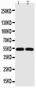 TP53 / p53 Antibody - WB of TP53 / p53 antibody. All lanes: Anti-P53 at 0.5ug/ml. Lane 1: HEPG2 Whole Cell Lysate at 40ug. Lane 2: COLO320 Whole Cell Lysate at 40ug. Predicted bind size: 53KD. Observed bind size: 53KD.