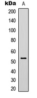 TP53 / p53 Antibody - Western blot analysis of p53 (AcK319) expression in HeLa TSA-treated (A) whole cell lysates.
