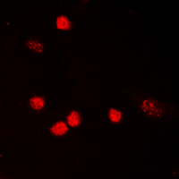 TP53 / p53 Antibody - Immunofluorescent analysis of p53 (AcK319) staining in HeLa cells. Formalin-fixed cells were permeabilized with 0.1% Triton X-100 in TBS for 5-10 minutes and blocked with 3% BSA-PBS for 30 minutes at room temperature. Cells were probed with the primary antibody in 3% BSA-PBS and incubated overnight at 4 deg C in a humidified chamber. Cells were washed with PBST and incubated with a DyLight 594-conjugated secondary antibody (red) in PBS at room temperature in the dark. DAPI was used to stain the cell nuclei (blue).