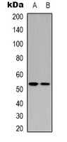TP53 / p53 Antibody - Western blot analysis of p53 (AcK370) expression in Jurkat (A); rat heart (B) whole cell lysates.