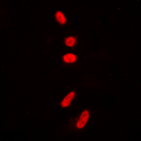 TP53 / p53 Antibody - Immunofluorescent analysis of p53 (AcK381) staining in HeLa cells. Formalin-fixed cells were permeabilized with 0.1% Triton X-100 in TBS for 5-10 minutes and blocked with 3% BSA-PBS for 30 minutes at room temperature. Cells were probed with the primary antibody in 3% BSA-PBS and incubated overnight at 4 deg C in a humidified chamber. Cells were washed with PBST and incubated with a DyLight 594-conjugated secondary antibody (red) in PBS at room temperature in the dark. DAPI was used to stain the cell nuclei (blue).