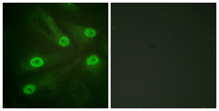 TP53 / p53 Antibody - Immunofluorescence analysis of HeLa cells, using p53 (Acetyl-Lys386) Antibody. The picture on the right is blocked with the synthesized peptide.