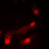 TP53 / p53 Antibody - Immunofluorescent analysis of p53 (AcK386) staining in HeLa cells. Formalin-fixed cells were permeabilized with 0.1% Triton X-100 in TBS for 5-10 minutes and blocked with 3% BSA-PBS for 30 minutes at room temperature. Cells were probed with the primary antibody in 3% BSA-PBS and incubated overnight at 4 C in a humidified chamber. Cells were washed with PBST and incubated with a DyLight 594-conjugated secondary antibody (red) in PBS at room temperature in the dark. DAPI was used to stain the cell nuclei (blue).