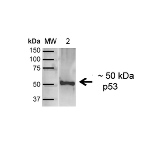 TP53 / p53 Antibody - Western blot analysis of Human A431 showing detection of ~43.7kDa p53 protein using Rabbit Anti-p53 Polyclonal Antibody. Lane 1: MW Ladder. Lane 2: Human A431 (20 µg). Load: 20 µg. Block: 5% milk + TBST for 1 hour at RT. Primary Antibody: Rabbit Anti-p53 Polyclonal Antibody  at 1:1000 for 1 hour at RT. Secondary Antibody: Goat Anti-Rabbit: HRP at 1:2000 for 1 hour at RT. Color Development: TMB solution for 12 min at RT. Predicted/Observed Size: ~43.7kDa.