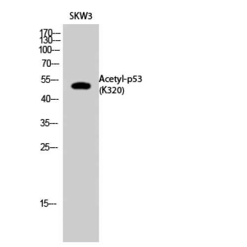 TP53 / p53 Antibody - Western blot of Acetyl-p53 (K320) antibody