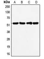 TP53 / p53 Antibody - Western blot analysis of p53 expression in MDAMB231 (A); HepG2 (B); MCF7 (C); A431 (D) whole cell lysates.