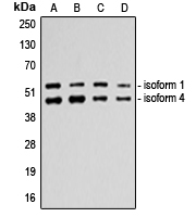 TP53 / p53 Antibody - Western blot analysis of p53 expression in A549 (A); HeLa (B); MDAMB231 (C); HepG2 (D) whole cell lysates.