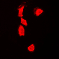 TP53 / p53 Antibody - Immunofluorescent analysis of p53 staining in HeLa cells. Formalin-fixed cells were permeabilized with 0.1% Triton X-100 in TBS for 5-10 minutes and blocked with 3% BSA-PBS for 30 minutes at room temperature. Cells were probed with the primary antibody in 3% BSA-PBS and incubated overnight at 4 C in a humidified chamber. Cells were washed with PBST and incubated with a DyLight 594-conjugated secondary antibody (red) in PBS at room temperature in the dark. DAPI was used to stain the cell nuclei (blue).