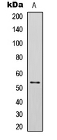 TP53 / p53 Antibody - Western blot analysis of p53 (pS392) expression in SKOV3 Etoposide-treated (A) whole cell lysates.
