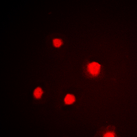 TP53 / p53 Antibody - Immunofluorescent analysis of p53 (pS392) staining in HeLa cells. Formalin-fixed cells were permeabilized with 0.1% Triton X-100 in TBS for 5-10 minutes and blocked with 3% BSA-PBS for 30 minutes at room temperature. Cells were probed with the primary antibody in 3% BSA-PBS and incubated overnight at 4 deg C in a humidified chamber. Cells were washed with PBST and incubated with a DyLight 594-conjugated secondary antibody (red) in PBS at room temperature in the dark. DAPI was used to stain the cell nuclei (blue).