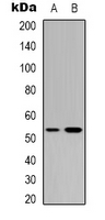 TP53 / p53 Antibody - Western blot analysis of p53 expression in HEK293T (A); HeLa (B) whole cell lysates.