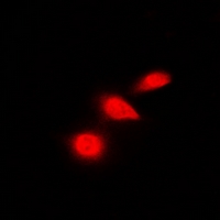 TP53 / p53 Antibody - Immunofluorescent analysis of p53 staining in HeLa cells. Formalin-fixed cells were permeabilized with 0.1% Triton X-100 in TBS for 5-10 minutes and blocked with 3% BSA-PBS for 30 minutes at room temperature. Cells were probed with the primary antibody in 3% BSA-PBS and incubated overnight at 4 deg C in a humidified chamber. Cells were washed with PBST and incubated with a DyLight 594-conjugated secondary antibody (red) in PBS at room temperature in the dark. DAPI was used to stain the cell nuclei (blue).