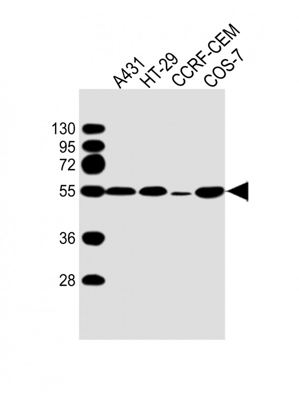 TP53 / p53 Antibody - All lanes: Anti-P53 Antibody at 1:2000 dilution Lane 1: A431 whole cell lysate Lane 2: HT-29 whole cell lysate Lane 3: CCRF-CEM whole cell lysate Lane 4: COS-7 whole cell lysate Lysates/proteins at 20 µg per lane. Secondary Goat Anti-mouse IgG, (H+L), Peroxidase conjugated at 1/10000 dilution. Predicted band size: 44 kDa Blocking/Dilution buffer: 5% NFDM/TBST.