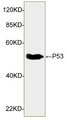 TP53 / p53 Antibody - Western blot analysis of UV-treated HEK 293 cell lysates using p53 Antibody (6F2D3), mAb, Mouse. The signal was developed with IRDye™ 800 Conjugated Goat Anti-Mouse IgG. Predicted Size: 53 KD Observed Size: 53 KD