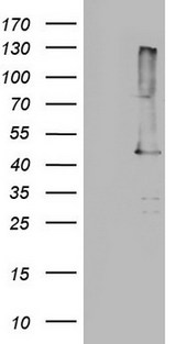 TP53 / p53 Antibody - HEK293T cells were transfected with the pCMV6-ENTRY control. (Left lane) or pCMV6-ENTRY. (Right lane) cDNA for 48 hrs and lysed. Equivalent amounts of cell lysates. (5 ug per lane) were separated by SDS-PAGE and immunoblotted with anti-TP53.