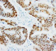 TP53 / p53 Antibody -  This image was taken for the unconjugated form of this product. Other forms have not been tested.
