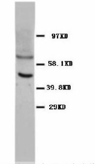 TP53 / p53 Antibody -  This image was taken for the unconjugated form of this product. Other forms have not been tested.
