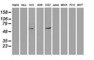 TP53 / p53 Antibody - Western blot of extracts (35 ug) from 9 different cell lines by using anti-TP53 monoclonal antibody.