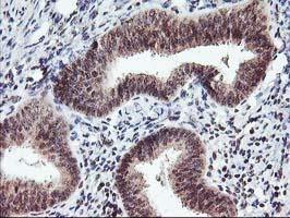 TP53 / p53 Antibody - IHC of paraffin-embedded Human endometrium tissue using anti-TP53 mouse monoclonal antibody. (Heat-induced epitope retrieval by 10mM citric buffer, pH6.0, 100C for 10min).