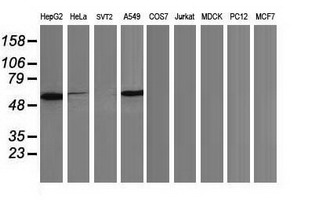 TP53 / p53 Antibody - Western blot of extracts (35ug) from 9 different cell lines by using anti-TP53 monoclonal antibody.