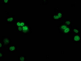 TP53 / p53 Antibody - Anti-TP53 mouse monoclonal antibody immunofluorescent staining of COS7 cells transiently transfected by pCMV6-ENTRY TP53.