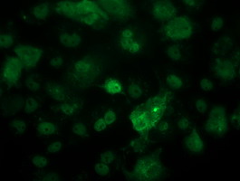 TP53 / p53 Antibody - Immunofluorescent staining of HeLa cells using anti-TP53 mouse monoclonal antibody.