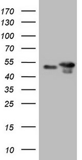 TP53 / p53 Antibody - HEK293T cells were transfected with the pCMV6-ENTRY control. (Left lane) or pCMV6-ENTRY. (Right lane) cDNA for 48 hrs and lysed. Equivalent amounts of cell lysates. (5 ug per lane) were separated by SDS-PAGE and immunoblotted with anti-TP53.