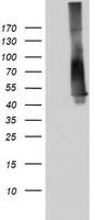 TP53 / p53 Antibody - HEK293T cells were transfected with the pCMV6-ENTRY control (Left lane) or pCMV6-ENTRY TP53 (Right lane) cDNA for 48 hrs and lysed. Equivalent amounts of cell lysates (5 ug per lane) were separated by SDS-PAGE and immunoblotted with anti-TP53.