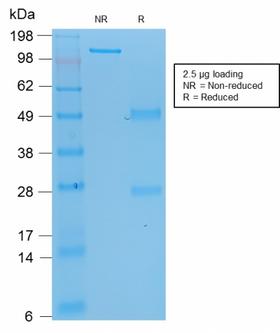 TP53 / p53 Antibody - SDS-PAGE Analysis Purified p53 Mouse Recombinant Monoclonal Antibody (rBP53-12). Confirmation of Purity and Integrity of Antibody