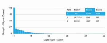 TP53 / p53 Antibody - Analysis of Protein Array containing more than 19,000 full-length human proteins using p53 Recombinant Rabbit Monoclonal Antibody (TP53/1799R)  Z- and S- Score: The Z-score represents the strength of a signal that a monoclonal antibody (MAb) (in combination with a fluorescently-tagged anti-IgG secondary antibody) produces when binding to a particular protein on the HuProtTM array. Z-scores are described in units of standard deviations (SD’s) above the mean value of all signals generated on that array. If targets on HuProtTM are arranged in descending order of the Z-score, the S-score is the difference (also in units of SD’s) between the Z-score. S-score therefore represents the relative target specificity of a MAb to its intended target.  A MAb is considered to specific to its intended target, if the MAb has an S-score of at least 2.5. For example, if a MAb binds to protein X with a Z-score of 43 and to protein Y with a Z-score of 14, then the S-score for the binding of that MAb to protein X is equal to 29.