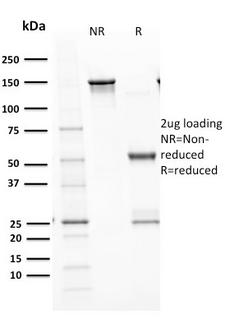 TP53 / p53 Antibody - SDS –PAGE Analysis Purified p53 Recombinant Rabbit Monoclonal Antibody (TP53/1799R). Confirmation of Purity and Integrity of Antibody.
