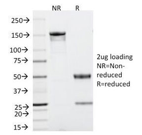 TP53 / p53 Antibody - SDS-PAGE Analysis of Purified, BSA-Free TP53 Antibody (clone TRP/816). Confirmation of Integrity and Purity of the Antibody.