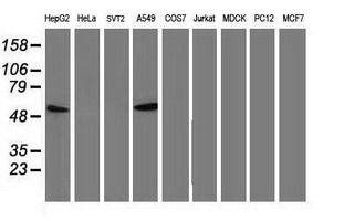 TP53 / p53 Antibody - Western blot analysis of extracts. (35ug) from 9 different cell lines by using anti-TP53 monoclonal antibody. (Clone UMAB18).