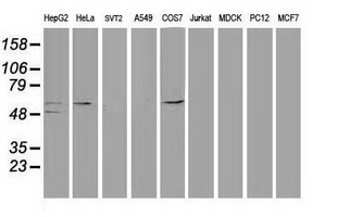 TP53 / p53 Antibody - Western blot analysis of extracts. (35ug) from 9 different cell lines by using anti-TP53 monoclonal antibody. (Clone UMAB 19).