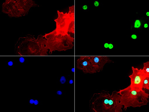 TP53 / p53 Antibody - Immunofluorescent staining of COS7 cells usingmouse monoclonal antibody  green). Actin filaments were labeled with TRITC-phalloidin. (red), and nuclear with DAPI. (blue). The three-color overlay image is located at the bottom-right corner.