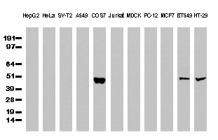 TP53 / p53 Antibody - Western Blot analysis of extracts. (35µg) from 11 different cell lines by using anti-TP53 monoclonal antibody. (Clone UMAB55)