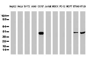 TP53 / p53 Antibody - Western Blot analysis of extracts. (35µg) from 11 different cell lines by using anti-TP53 monoclonal antibody. (Clone UMAB62)