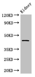 TP53 / p53 Antibody - Western Blot Positive WB detected in: Mouse kidney tissue All lanes: Tp53 antibody at 2.5µg/ml Secondary Goat polyclonal to rabbit IgG at 1/50000 dilution Predicted band size: 44 kDa Observed band size: 44 kDa