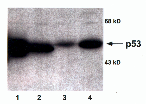 TP53 / p53 Antibody - Each lane contains 50 ug of total cellular protein separated by 10% SDS-PAGE. (1) Murine mutant p53; (2) murine wild-type p53; (3) wild-type p53 protein from human colorectal carcinoma cells (RKO); (4) elevated levels of human p53 protein following treatment of RKO cells with Adriamycin (0.2 um).