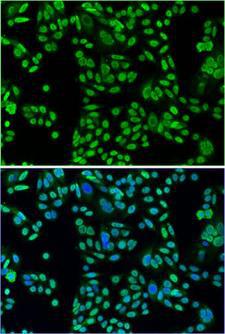 TP53 / p53 Antibody - Immunofluorescence analysis.