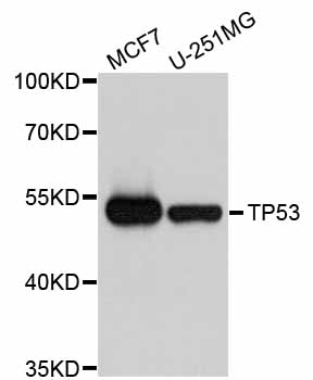 TP53 / p53 Antibody - Western blot analysis of extracts of various cell lines, using TP53 antibody at 1:1000 dilution. The secondary antibody used was an HRP Goat Anti-Rabbit IgG (H+L) at 1:10000 dilution. Lysates were loaded 25ug per lane and 3% nonfat dry milk in TBST was used for blocking. An ECL Kit was used for detection and the exposure time was 90s.