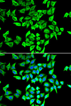 TP53 / p53 Antibody - Immunofluorescence analysis of A549 cells using TP53 antibody.