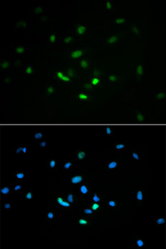 TP53 / p53 Antibody - Immunofluorescence analysis of MCF7 cells.