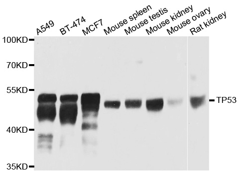 TP53 / p53 Antibody - Western blot analysis of extracts of various cell lines.