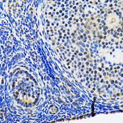 TP53 / p53 Antibody - Immunohistochemistry of paraffin-embedded rat ovary tissue.