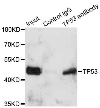 TP53 / p53 Antibody - Immunoprecipitation analysis of 150ug extracts of A549 cells.